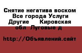 Снятие негатива воском. - Все города Услуги » Другие   . Кировская обл.,Луговые д.